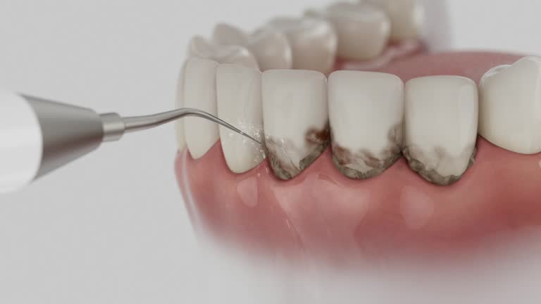 Trusted Teeth Cleaning And Checkup service in Eastpointe, MI - Dentist Open Now